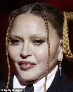 Plastic-surgeons-weigh-in-on-Madonnas-unrecognizable-face-likely-had-a.jpg